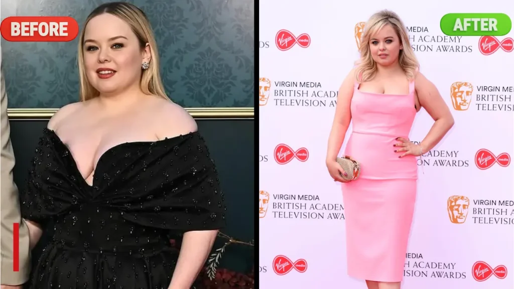 Nicola Coughlan Weight Loss Before and After