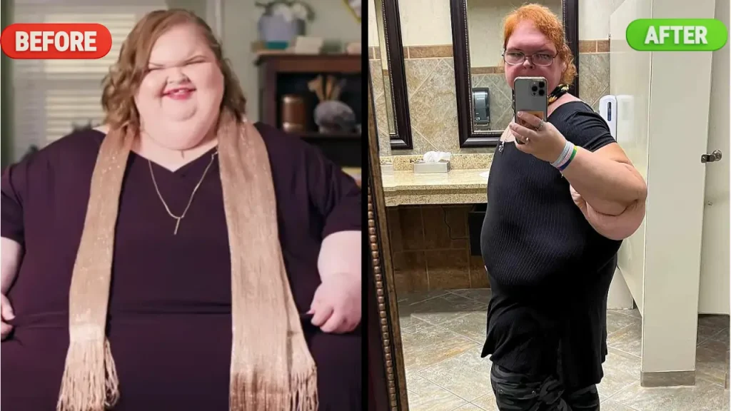 Tammy Slaton Weight Loss Before and After