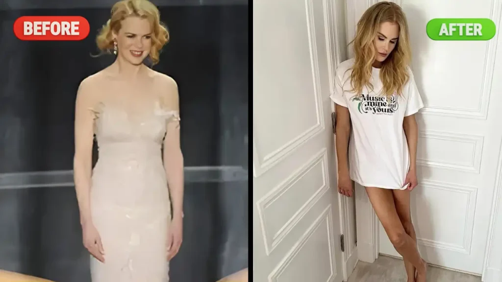 Nicole Kidman Weight Loss