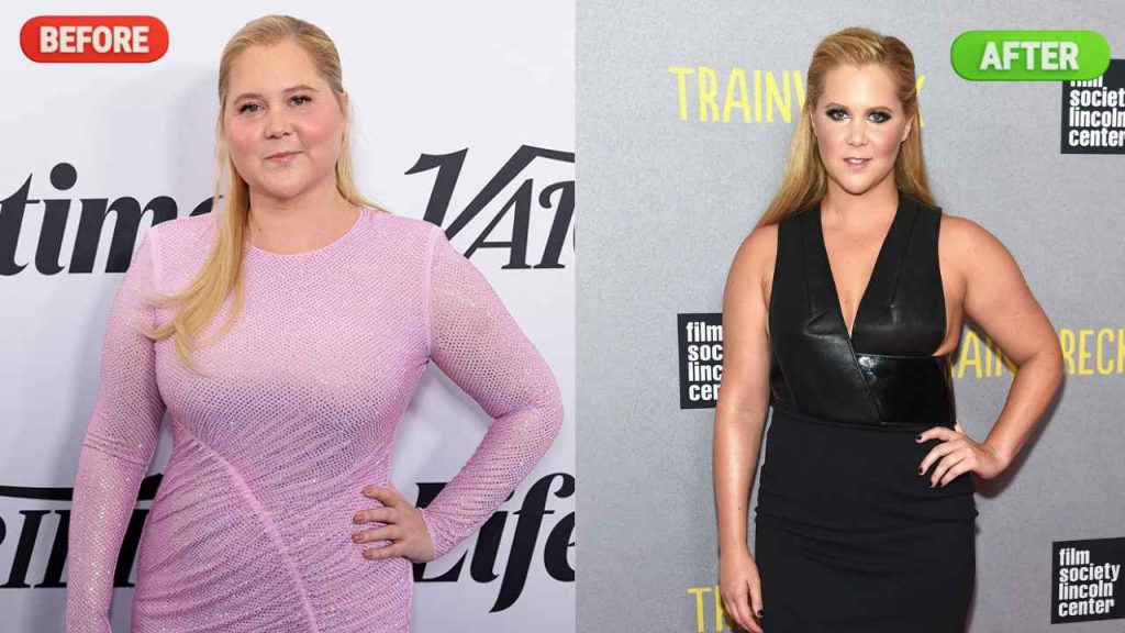 Is Amy Schumer Uses Ozempic For Weight Loss?