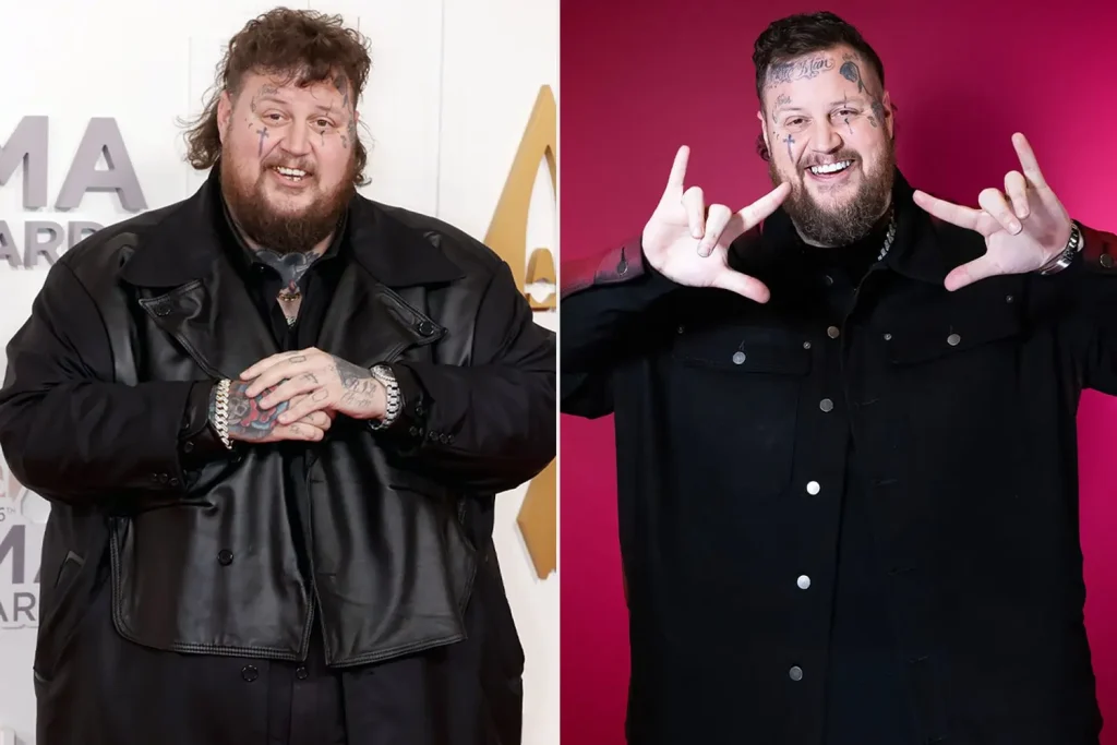 Jelly Roll Weight Loss Before and After